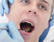 歯を治療する男性